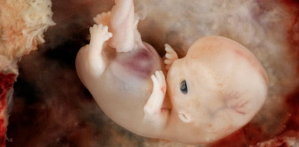 8-weeks-2.jpg 8-weeks-2.jpg