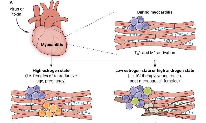 Hormone therapy could lower risk of immunotherapy-associated myocarditis in women