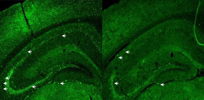 A new method for treating Alzheimer’s disease