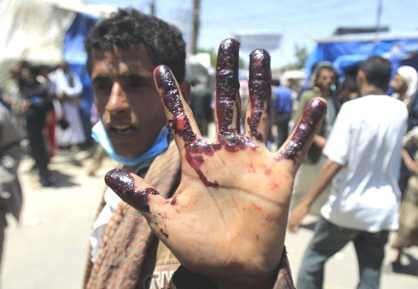 Hands off Yemen