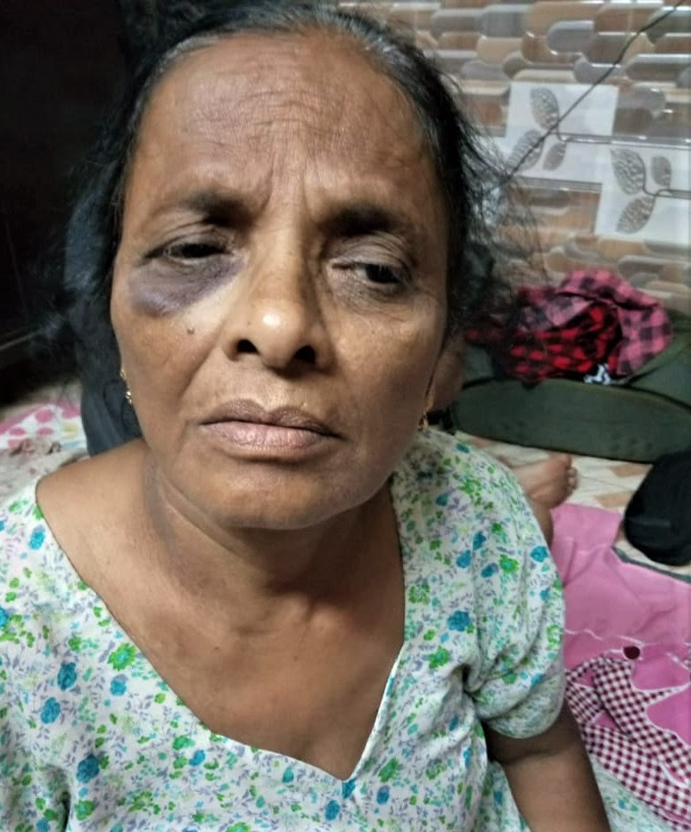 Sarla Mangala, 65, was among those assaulted in Hindu extremist attack in Sohna, Haryana state, India on Sept. 22, 2019. (Morning Star News)