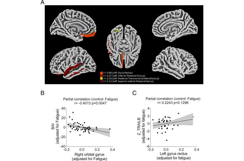 Evidence of SARS-CoV-2 virus infecting astrocyte cells in the brain