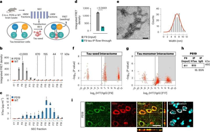 Researchers identify protein that contributes to tau neurotoxicity in Alzheimer's disease