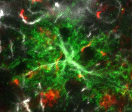 Lack of key neuropeptide induces neuroinflammation to impair neural stem cells and limit new neuron production