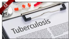 Interactive Core Curriculum on Tuberculosis