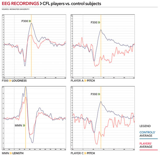 EEG-Recordings_2