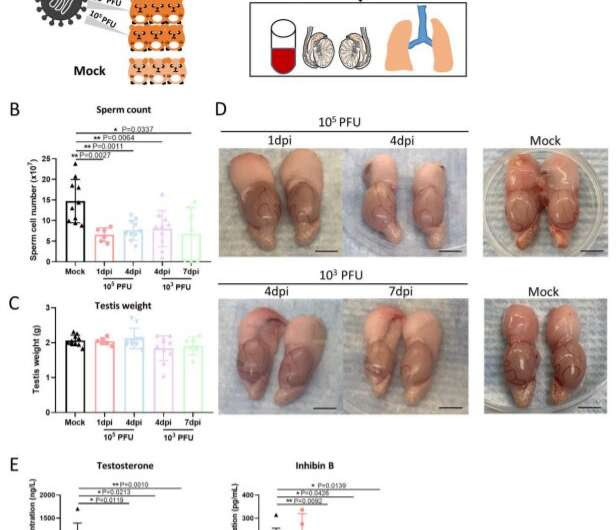 Microbiology researchers find COVID-19 virus causing testicular damage and atrophy