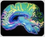 Protein supplement L-norvaline may lead to neurodegenerative diseases