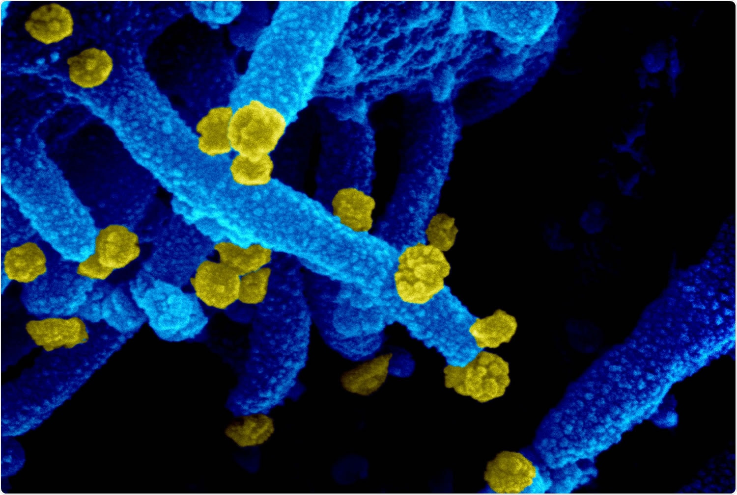 Study: Ineffective neutralization of the SARS-CoV-2 Mu variant by convalescent and vaccine sera. Image Credit: NIAID