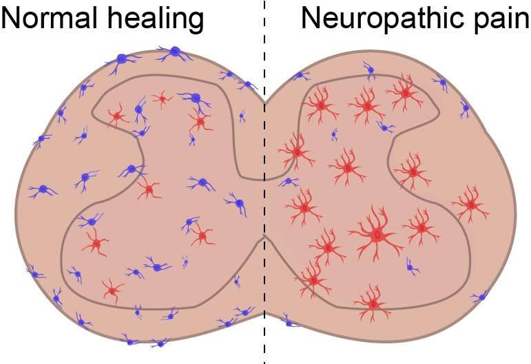 Scientists find new cell type implicated in chronic pain, inflammation