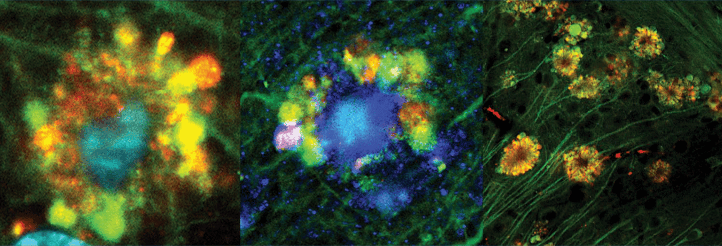 Flower-like formations can be seen around cells due to dipping acidity levels in lysosomes