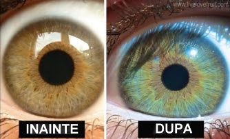 inainte dupa ochi