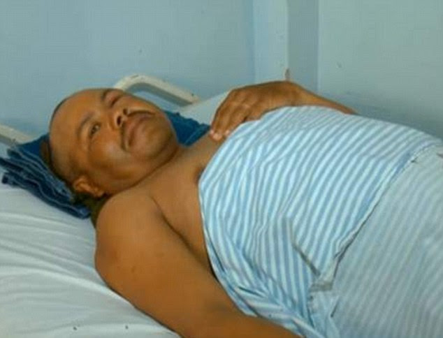 Luck: Despite his serious injuries, motorcycle taxi driver Juacelo Nunes (pictured) is expected to make a full recovery and is looking forward to spending tonight's New Year celebrations at home with his wife