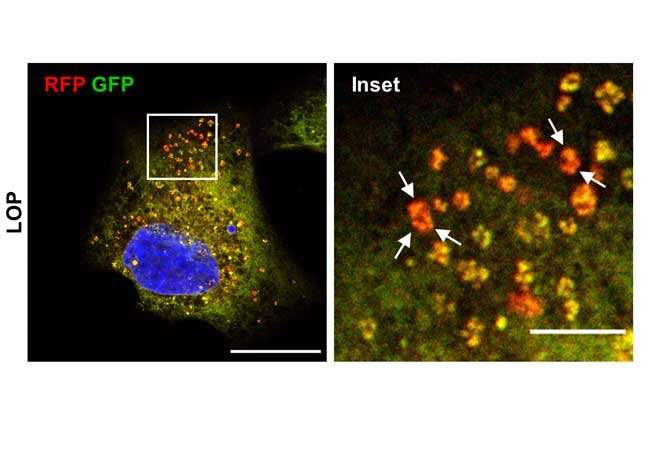 Anti-diarrhoea drug drives cancer cells to cell death