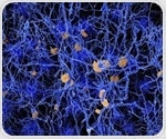 Mice study raises hope to successfully treat Alzheimer's disease