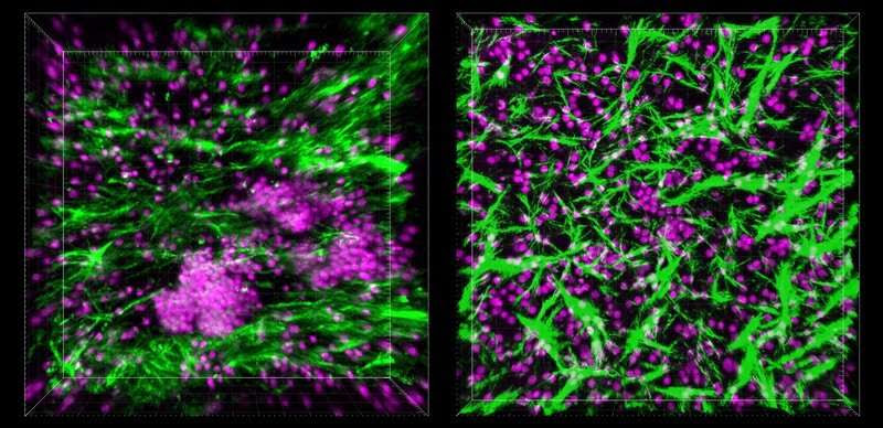 The immune system is very complicated, but now, it's on a chip