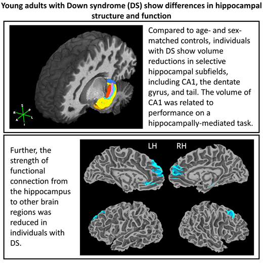 Subtle differences in structure and function of the hippocampus in people with Down syndrome