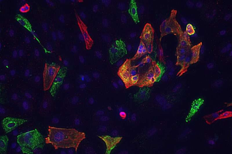 Identifying the cause and potential treatment for COVID-19-induced heart damage