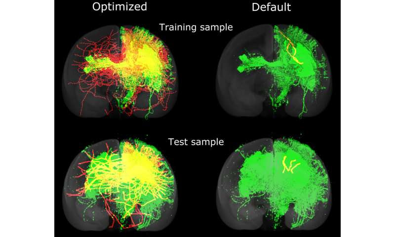 Machine intelligence accelerates research into mapping brains