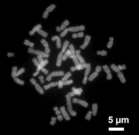 Chromosomes