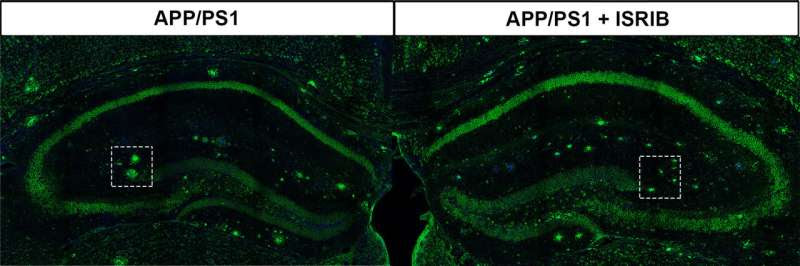 Scientists find promising avenue to restore cognitive function impaired by Alzheimer's disease