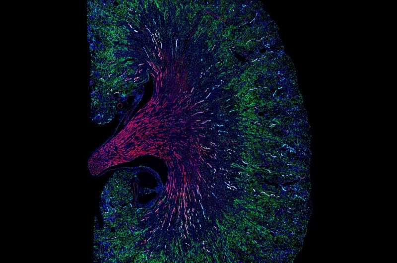 The same cell type can help or hinder kidney repair after acute injury