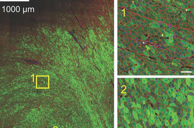 New research moves novel gene therapy for heart failure closer to the clinic