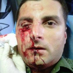 Image of Border Patrol Agent after being attacked by illegal aliens