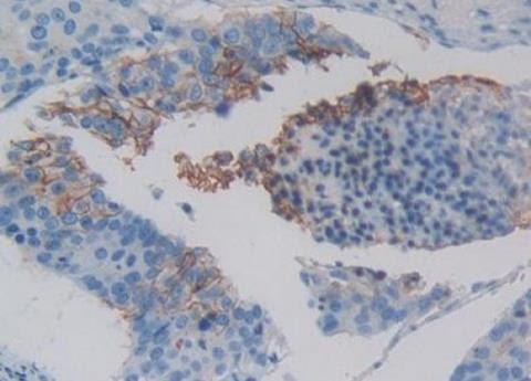 IHC-P analysis of Kidney tissue, with DAB staining.