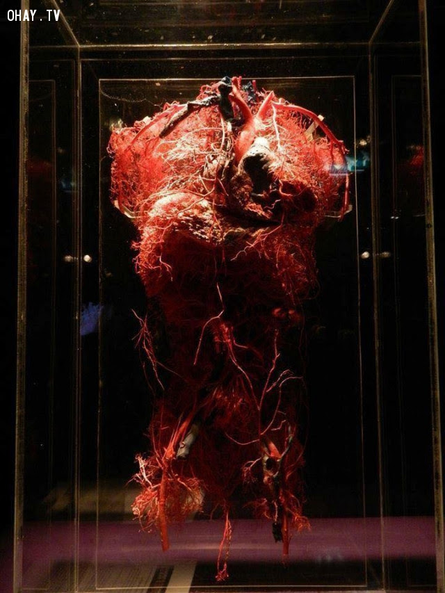 Hệ thống mạch máu phần trên của cơ thể,cơ thể con người