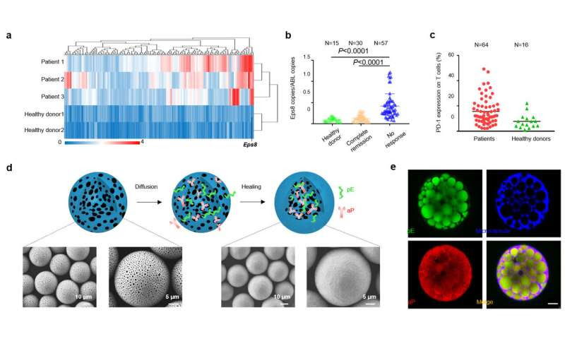 Scientists develop new precise therapeutic leukemia vaccine