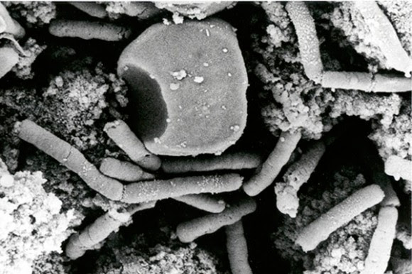 La imagen muestra esporas o células vegetativas de ántrax, que causan el carbunco al llegar a los pulmones. Foto: AP/Anthrax Vaccine Immunization 