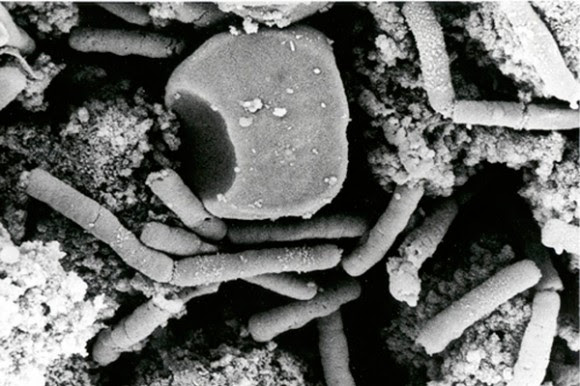 La imagen muestra esporas o células vegetativas de ántrax, que causan el carbunco al llegar a los pulmones. Foto: AP/Anthrax Vaccine Immunization