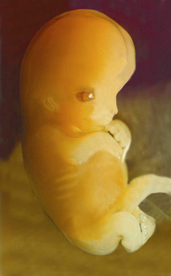 مراحل تكوين الجنين بالصور----- تبارك الله احسن الخالقين - صفحة 2 Fig20baby7
