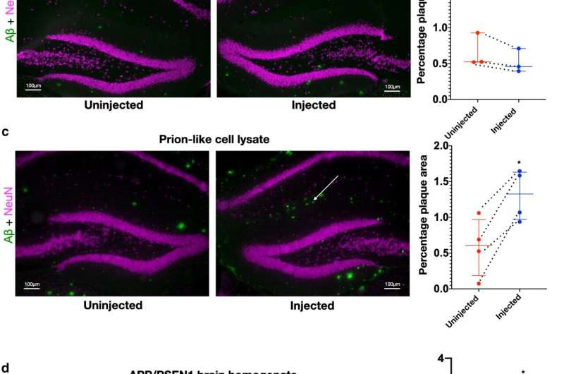 Alzheimer's disease may start inside nerve cells