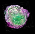Spatial Heterogeneity in the Tumor Microenvironment
