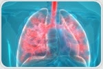 Identifying Protein Biomarkers for COPD from Exhaled Air Condensate