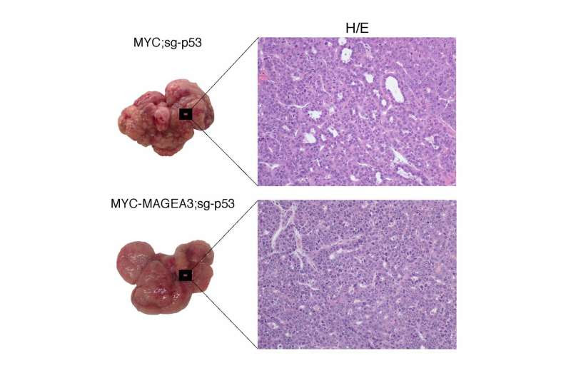 Genetic study of liver cancer reveals new drug target