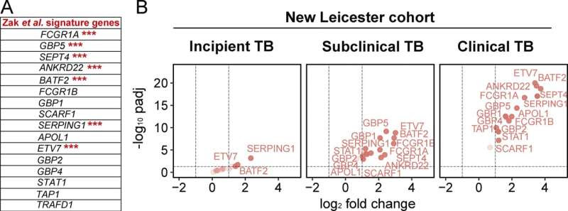 Clues to tuberculosis progression found in gene expression