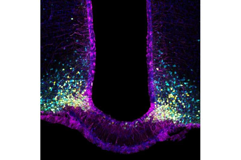 Diabetes: Study of satiety mechanism yields new knowledge