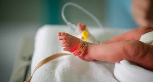 premature-baby-foot-monitor