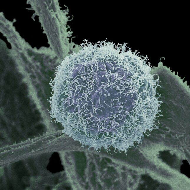 Human Melanoma Cell