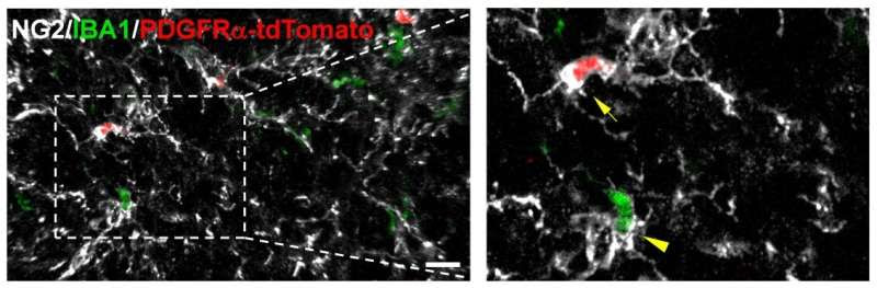 Researchers identify new cell source for microgliosis in neurodegenerative diseases