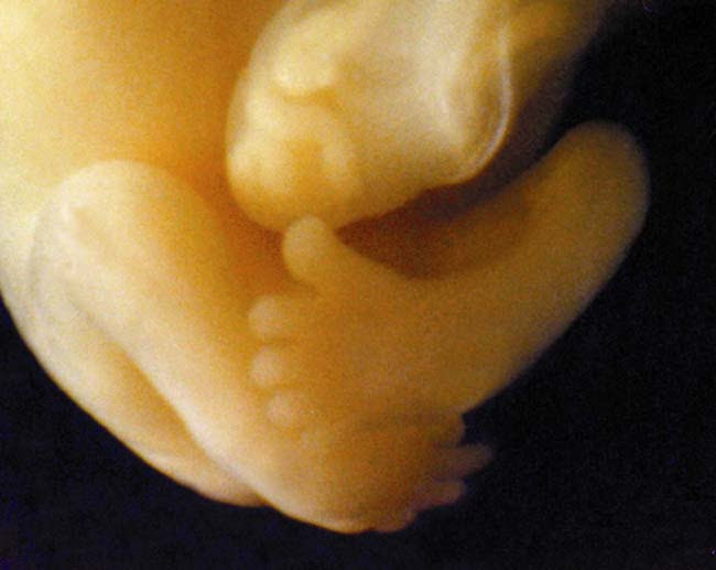 مراحل تكوين الجنين بالصور----- تبارك الله احسن الخالقين Fig12legs7