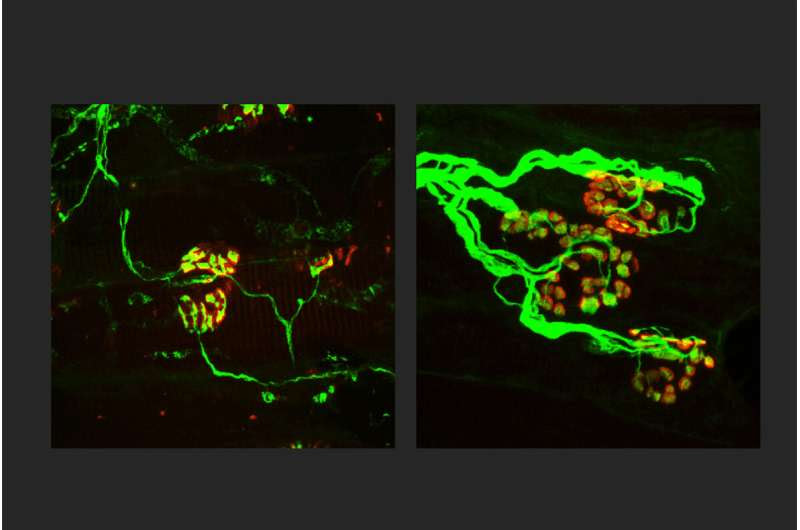 New strategy shows potential to block nerve loss in neurodegenerative diseases