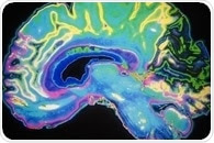 New screening platform helped scientists to discover drug-like compounds