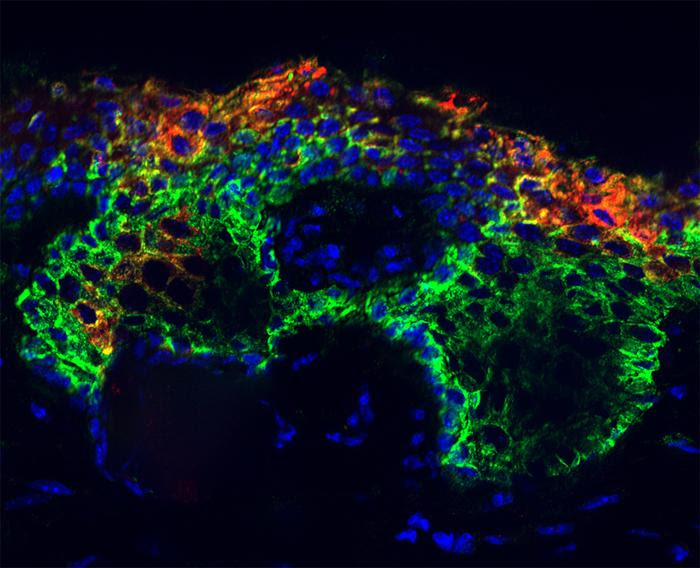 SOX9 in the epidermis