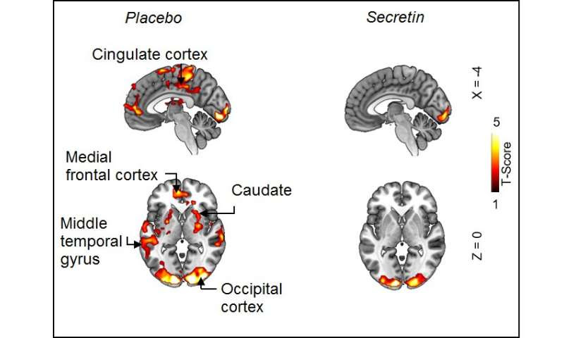 Secretin hormone induces satiation by activating brown fat