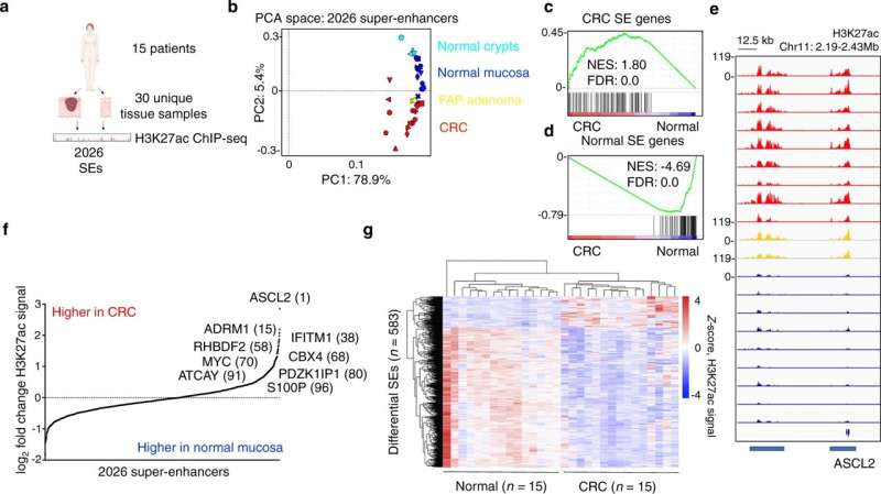 Study identifies new gene that drives colon cancer