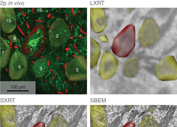 Scientists build subcellular map of entire brain networks